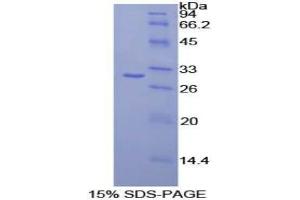 SDS-PAGE analysis of Human CELSR2 Protein.
