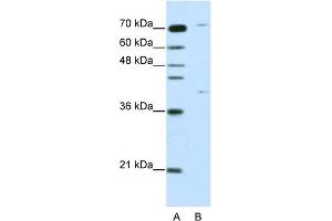 WB Suggested Anti-ZNF668 Antibody Titration:  1.