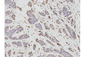 Immunohistochemistry (IHC) image for anti-DKK3 antibody (ABIN1872281) (DKK3 antibody)