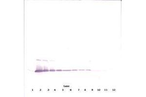 Image no. 1 for anti-Interleukin 17A (IL17A) antibody (ABIN465354) (Interleukin 17a antibody)