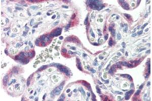 Human Placenta (formalin-fixed, paraffin-embedded) stained with CYP26A1 antibody ABIN364310 at 10 ug/ml followed by biotinylated anti-mouse IgG secondary antibody ABIN481714, alkaline phosphatase-streptavidin and chromogen. (CYP26A1 antibody  (C-Term))