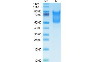 Syndecan 1 Protein (SDC1) (AA 23-254) (His tag)