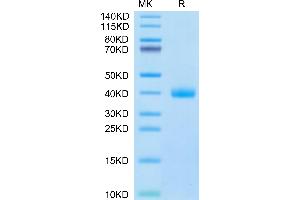 Cynomolgus IL-22R alpha 1 on Tris-Bis PAGE under reduced condition. (IL22 Receptor alpha 1 Protein (AA 18-225) (His tag))