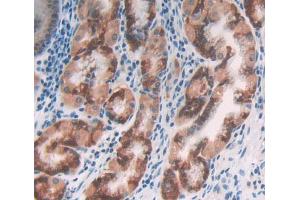Used in DAB staining on fromalin fixed paraffin- embedded Kidney tissue (MOCS1 antibody  (AA 1-160))