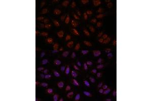 Immunofluorescence analysis of U-2 OS cells using DDX24 antibody (ABIN7266691) at dilution of 1:100. (DDX24 antibody  (AA 510-859))