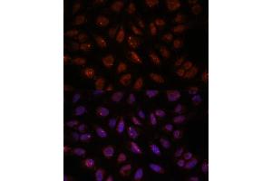 Immunofluorescence analysis of U-2 OS cells using DDX24 antibody (ABIN7266691) at dilution of 1:100. (DDX24 antibody  (AA 510-859))