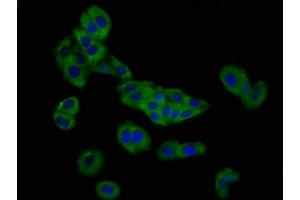 Immunofluorescence staining of HepG2 cells with ABIN7162742 at 1:166, counter-stained with DAPI. (SLC26A4 antibody  (AA 592-655))