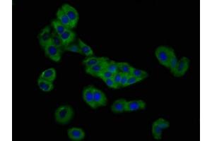 Immunofluorescence staining of HepG2 cells with ABIN7162742 at 1:166, counter-stained with DAPI.