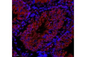 Immunofluorescence of paraffin embedded rat testis using GK2 (ABIN7074096) at dilution of 1: 500 (300x lens) (GK2 antibody)