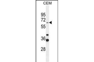 ZN Antibody (Center) (ABIN654509 and ABIN2844236) western blot analysis in CEM cell line lysates (35 μg/lane). (ZNF667 antibody  (AA 303-331))