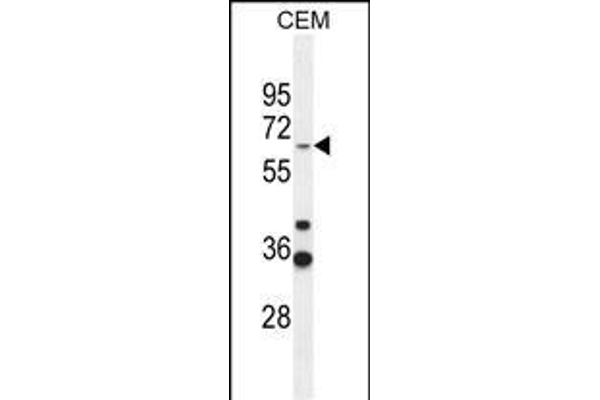 ZNF667 antibody  (AA 303-331)