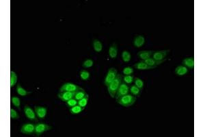 Immunofluorescent analysis of PC-3 cells using ABIN7142858 at dilution of 1:100 and Alexa Fluor 488-congugated AffiniPure Goat Anti-Rabbit IgG(H+L) (NUDT1 antibody  (AA 49-82))