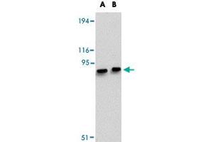 Western blot analysis of MACC1 in mouse liver tissue lysate with MACC1 polyclonal antibody  at (A) 1 and (B) 2 ug/mL . (MACC1 antibody  (Internal Region))