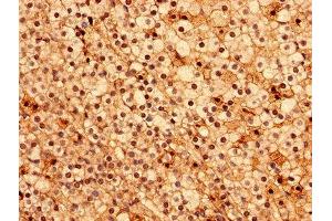 Immunohistochemistry (IHC) image for anti-Acyl-CoA Thioesterase 9 (Acot9) (AA 1-212) antibody (ABIN7143242)