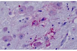 Anti-PPYR1 antibody IHC staining of human brain, hypothalamus. (NPY4R antibody  (Cytoplasmic Domain))