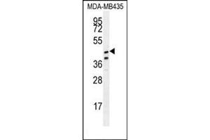 Western blot analysis in MDA-MB435 cell line lysates (35 µg/lane) using SAMD7 Antibody (Center) Cat. (SAMD7 antibody  (Middle Region))