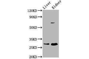 Western Blot Positive WB detected in: Rat liver tissue, Rat kidney tissue All lanes: PEX11A antibody at 2. (PEX11A antibody  (AA 106-219))