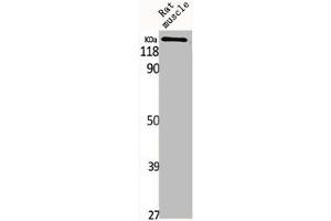 MYOM2 antibody  (Internal Region)