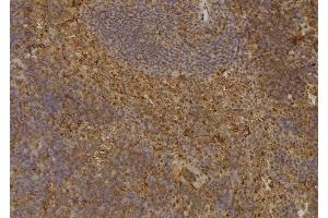 ABIN6277053 at 1/100 staining Mouse spleen tissue by IHC-P. (CDKN3 antibody  (Internal Region))