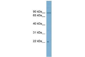WB Suggested Anti-C12orf11 Antibody Titration: 0. (C12orf11 antibody  (Middle Region))