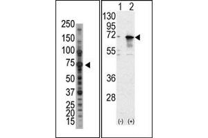 Image no. 1 for anti-Protein Inhibitor of Activated STAT, 1 (PIAS1) (N-Term) antibody (ABIN356762) (PIAS1 antibody  (N-Term))