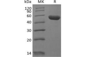 Western Blotting (WB) image for Leukocyte-Associated Immunoglobulin-Like Receptor 2 (LAIR2) protein (Fc Tag) (ABIN7319838) (LAIR2 Protein (Fc Tag))