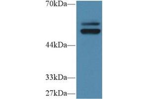 Western Blot; Sample: Human HL60 cell lysate; Primary Ab: 1µg/ml Rabbit Anti-Human PTPN5 Antibody Second Ab: 0. (PTPN5 antibody  (AA 331-558))