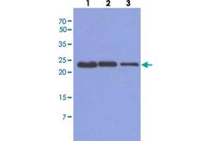 Western blot analysis of Mouse muscle extract (40 ug) by using TNNI1 monoclonal antibody, clone AT36E7  (1:500-1:5000).