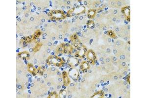 Immunohistochemistry of paraffin-embedded Mouse kidney using PHPT1 Polyclonal Antibody at dilution of 1:100 (40x lens). (PHPT1 antibody)