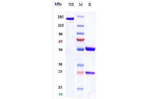 Anti-Nectin-4 Reference Antibody (enfortumab) on SDS-PAGE under reducing (R) condition. (Recombinant Nectin-4 (Enfortumab Biosimilar) antibody)