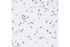 Immunohistochemistry of paraffin-embedded mouse brain using TriMethyl-Histone H3-K64 antibody (ABIN7267701) at dilution of 1:100 (40x lens). (Histone 3 antibody  (H3K64me3))