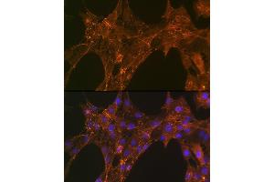 Immunofluorescence (IF) image for anti-Actinin, alpha 4 (ACTN4) antibody (ABIN7265399)