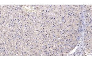 Immunohistochemistry (IHC) image for anti-Complement Component Receptor 1 (CD35) (CR1) (AA 1780-2039) antibody (ABIN7433177)