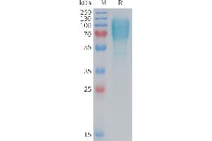 Mouse GC Protein, His Tag on SDS-PAGE under reducing condition.