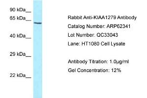 Western Blotting (WB) image for anti-KIAA1279 (KIAA1279) (C-Term) antibody (ABIN2774341) (KIF1BP antibody  (C-Term))