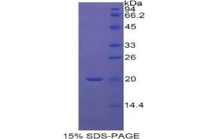 SDS-PAGE analysis of Human RBP5 Protein.