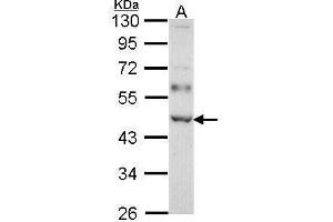 WB Image Sample (30 ug of whole cell lysate) A: Molt-4 , 10% SDS PAGE WTAP antibody antibody diluted at 1:1000 (WTAP antibody  (Center))
