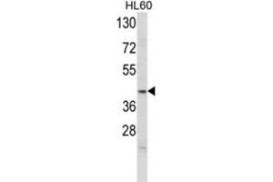 Western Blotting (WB) image for anti-Apolipoprotein L, 4 (APOL4) antibody (ABIN3002795) (Apolipoprotein L 4 antibody)