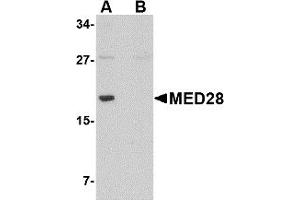 Western Blotting (WB) image for anti-Mediator Complex Subunit 28 (MED28) (Middle Region) antibody (ABIN1031001)