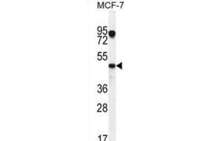 Western Blotting (WB) image for anti-Vascular Endothelial Growth Factor C (VEGFC) antibody (ABIN2996454) (VEGFC antibody)