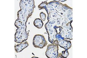 Immunohistochemistry of paraffin-embedded human placenta using CD46 Rabbit pAb (ABIN3022325, ABIN3022326, ABIN1512715, ABIN1513898 and ABIN6218741) at dilution of 1:100 (40x lens). (CD46 antibody  (AA 40-320))