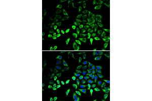 Immunofluorescence analysis of U2OS cells using PKM2 antibody . (PKM antibody  (AA 11-221))