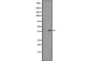 Western blot analysis of OPRL1 expression in A431 whole cell lysate ,The lane on the left is treated with the antigen-specific peptide. (OPRL1 antibody  (C-Term))