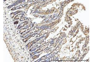IHC analysis of CA1 using anti-CA1 antibody (ABIN3043766). (CA1 antibody  (AA 9-261))