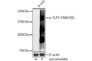 Western blot analysis of extracts of A-431 cells, using Phospho-FLT3-Y589/591 antibody (ABIN6135223, ABIN6136082, ABIN6136083 and ABIN6225559) at 1:500 dilution. (FLT3 antibody  (pTyr589, pTyr591))