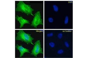 Immunofluoresence staining of fixed HeLa cells with anti-ED-B domain of fibronectin antibody A2. (Recombinant ED-B Domain of Fibronectin antibody)