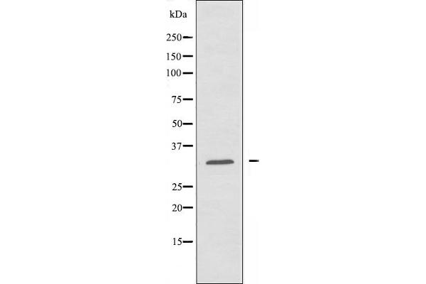 AIG1 antibody  (C-Term)