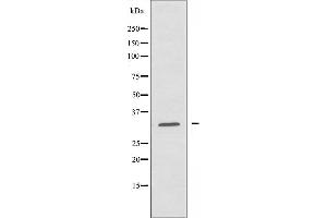 Western blot analysis of extracts from Jurkat cells using AIG1 antibody.