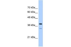 WB Suggested Anti-PGAM2 Antibody Titration:  0. (PGAM2 antibody  (N-Term))
