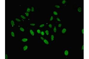 Immunofluorescent analysis of Hela cells using ABIN7144263 at dilution of 1:100 and Alexa Fluor 488-congugated AffiniPure Goat Anti-Rabbit IgG(H+L) (Annexin A11 antibody  (AA 276-505))